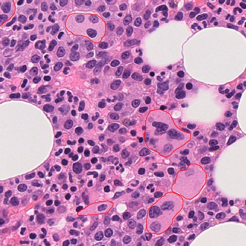 Megakaryocyte detection